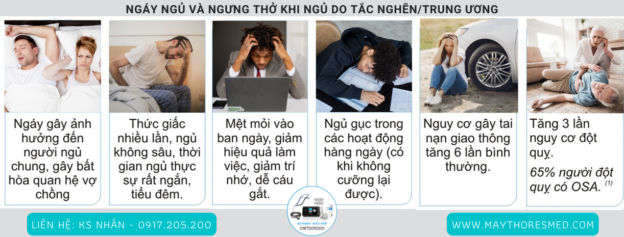 hội chứng ngưng thở khi ngủ