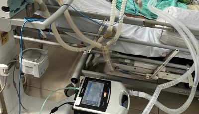Hệ thống máy thở đa năng ResMed Astral được cấu hình mạch thở xâm nhập khép kín tại phòng hồi sức tích cực, giúp kiểm soát toàn diện thể tích và áp lực đường thở khi bệnh nhân suy hô hấp nặng.