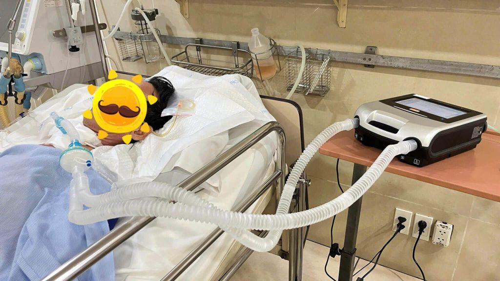 Hệ thống thiết bị cao cấp phục vụ nhu cầu thuê máy thở icu xâm lấn cho bệnh nhân nặng