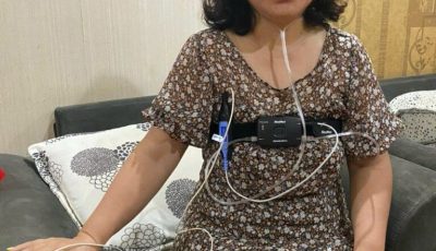 Đo đa ký giấc ngủ giúp ghi nhận chỉ số AHI, số lần ngưng thở và giảm thở trong mỗi giờ ngủ để hỗ trợ chẩn đoán hội chứng ngưng thở khi ngủ do tắc nghẽn (OSA).