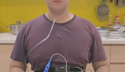Đo đa ký hô hấp tại nhà bằng thiết bị ResMed ApneaLink Air giúp ghi nhận các thông số hô hấp trong khi ngủ để hỗ trợ chẩn đoán hội chứng ngưng thở khi ngủ do tắc nghẽn (OSA).